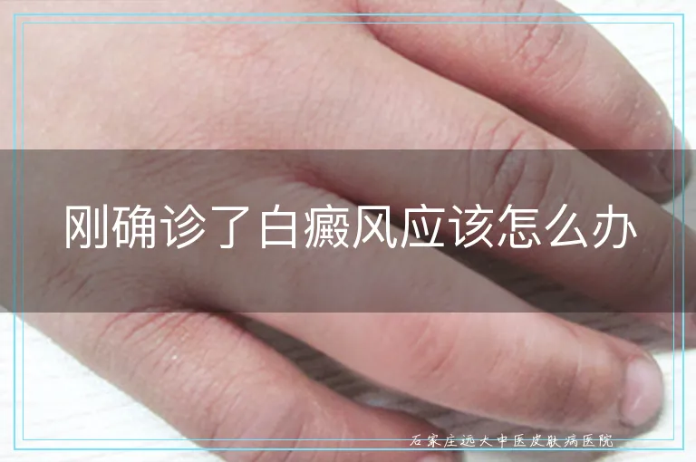 刚确诊了白癜风应该怎么办