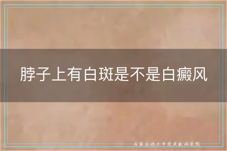 脖子上有白斑是不是白癜风