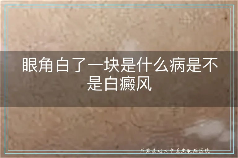 眼角白了一块是什么病是不是白癜风