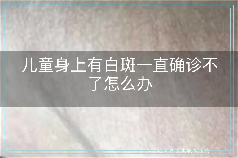 儿童身上有白斑一直确诊不了怎么办
