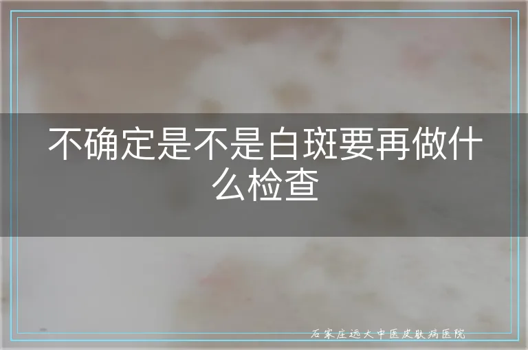 不确定是不是白斑要再做什么检查