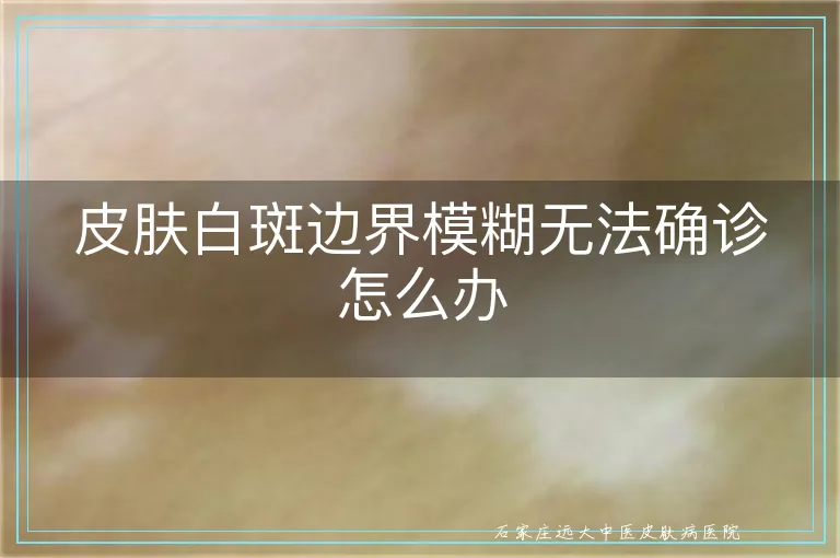 皮肤白斑边界模糊无法确诊怎么办