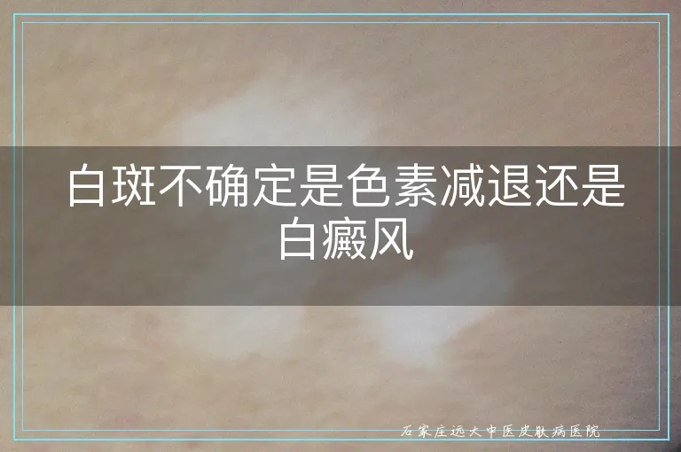 白斑不确定是色素减退还是白癜风