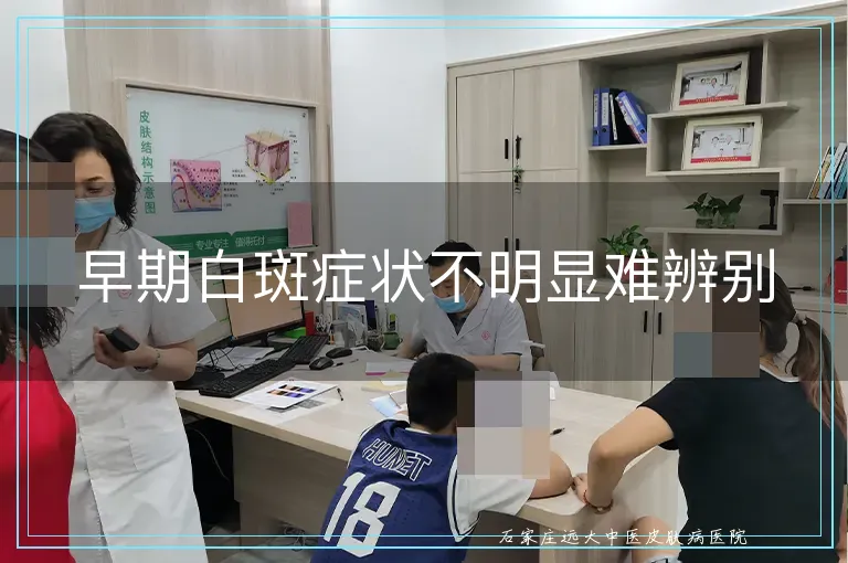 早期白斑症状不明显难辨别