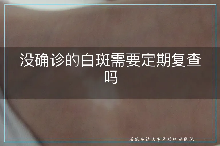 没确诊的白斑需要定期复查吗