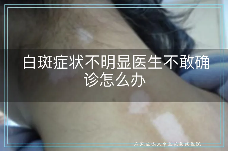 白斑症状不明显医生不敢确诊怎么办