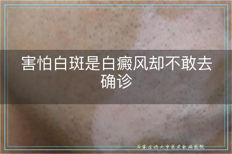 害怕白斑是白癜风却不敢去确诊