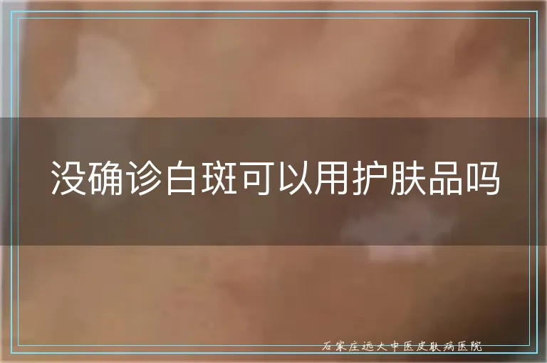 没确诊白斑可以用护肤品吗