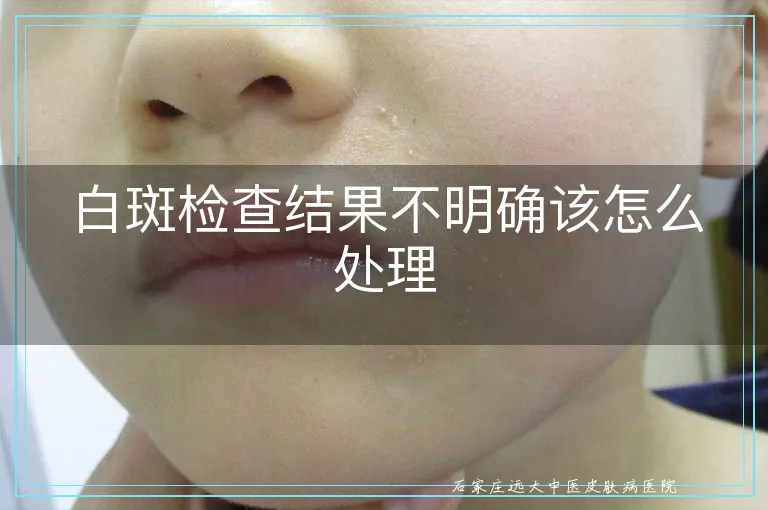 白斑检查结果不明确该怎么处理