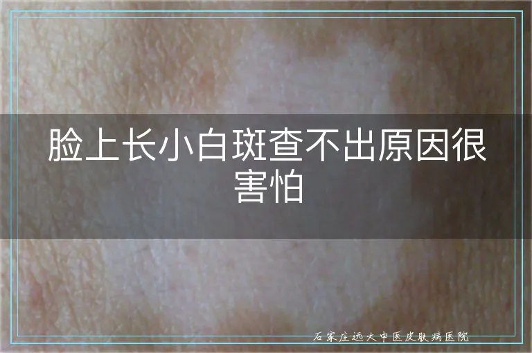 脸上长小白斑查不出原因很害怕