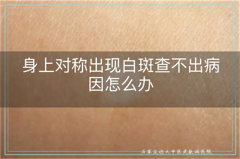 身上对称出现白斑查不出病因怎么办
