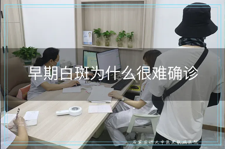 早期白斑为什么很难确诊