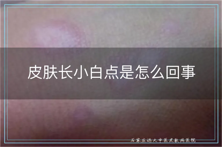 皮肤长小白点是怎么回事