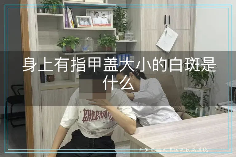 身上有指甲盖大小的白斑是什么