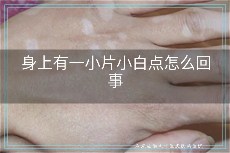 身上有一小片小白点怎么回事