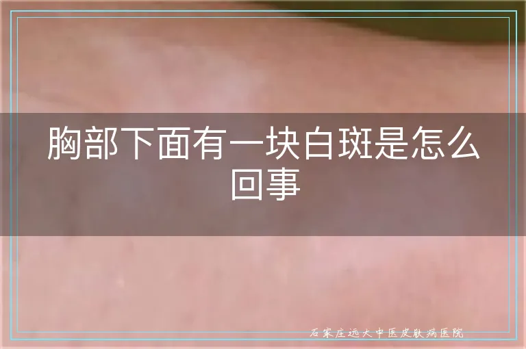 胸部下面有一块白斑是怎么回事