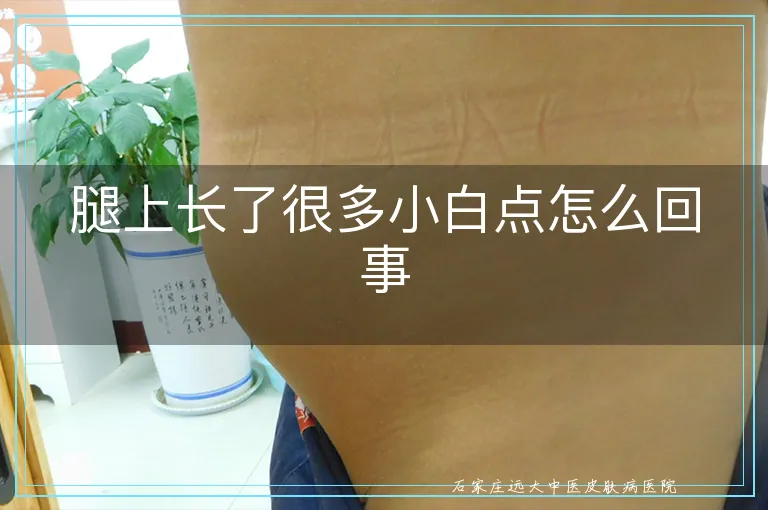 腿上长了很多小白点怎么回事
