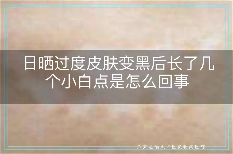 日晒过度皮肤变黑后长了几个小白点是怎么回事