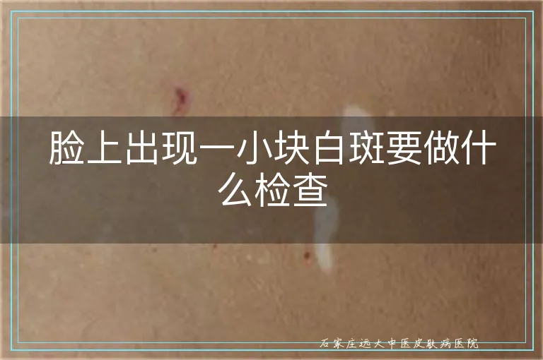 脸上出现一小块白斑要做什么检查