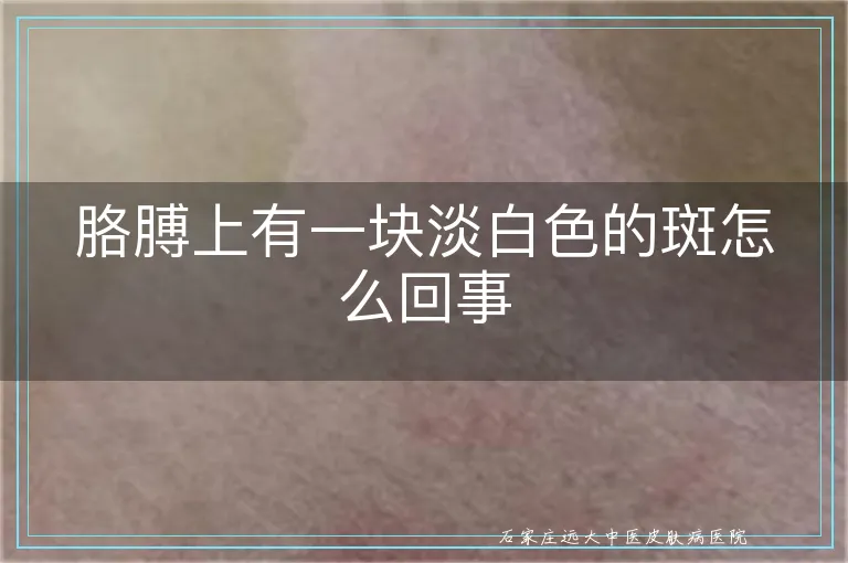 胳膊上有一块淡白色的斑怎么回事