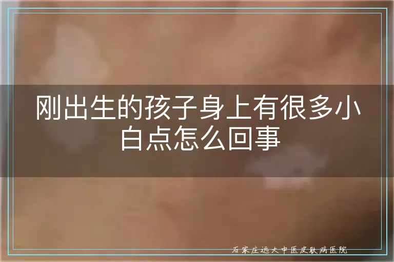刚出生的孩子身上有很多小白点怎么回事
