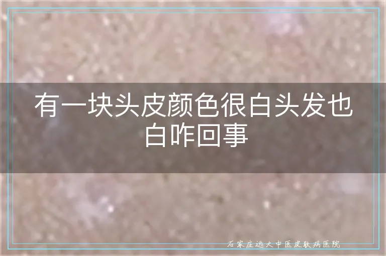 有一块头皮颜色很白头发也白咋回事