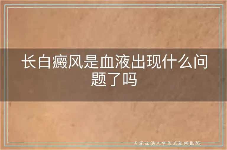 长白癜风是血液出现什么问题了吗