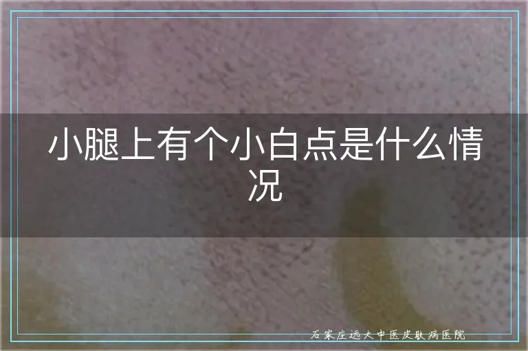 小腿上有个小白点是什么情况