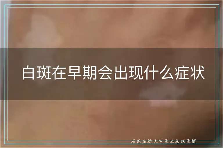 白斑在早期会出现什么症状