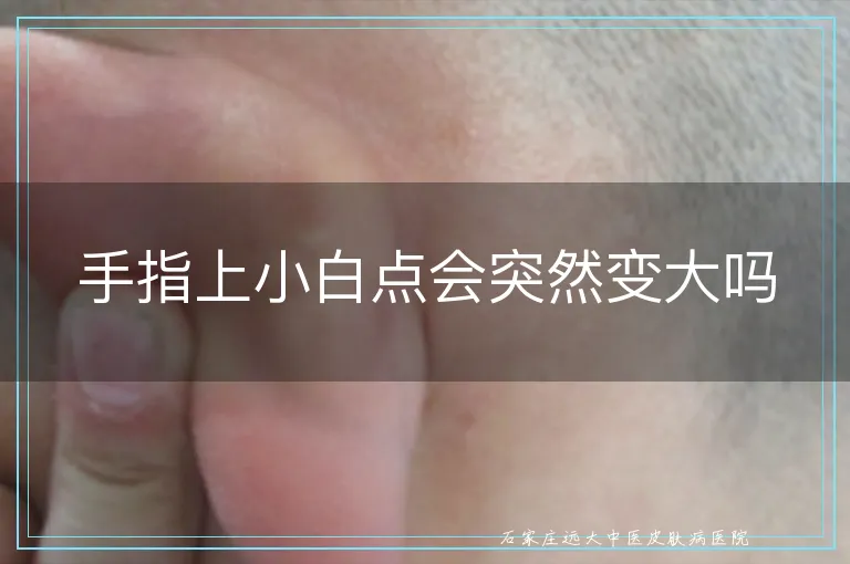手指上小白点会突然变大吗