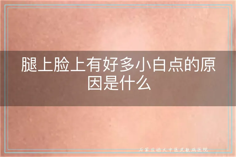 腿上脸上有好多小白点的原因是什么