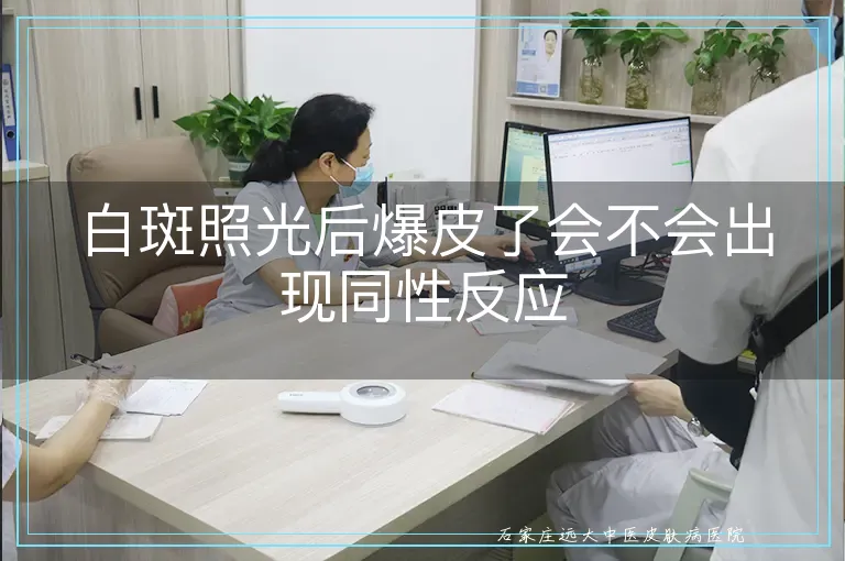 白斑照光后爆皮了会不会出现同性反应