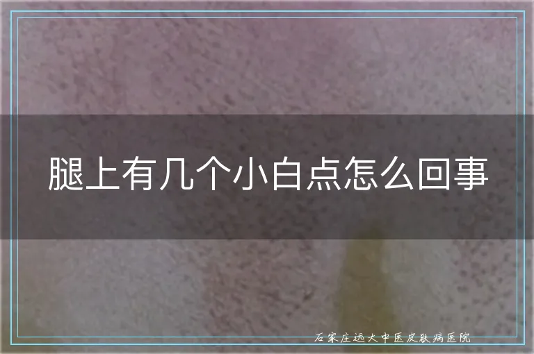 腿上有几个小白点怎么回事