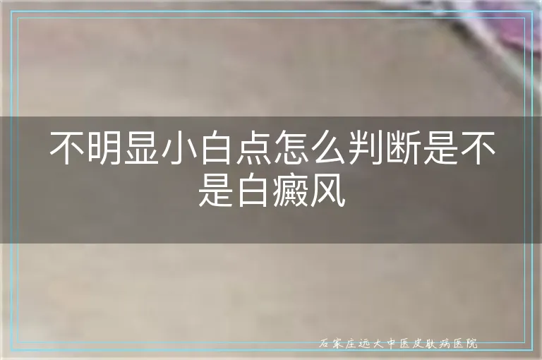 不明显小白点怎么判断是不是白癜风