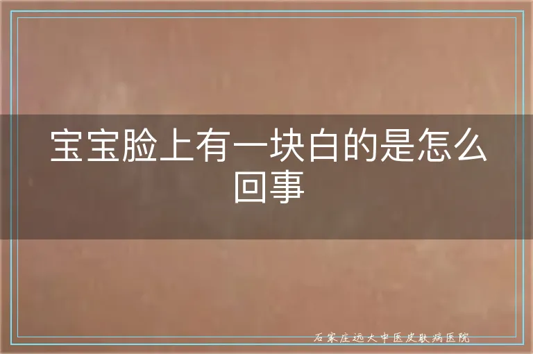 宝宝脸上有一块白的是怎么回事