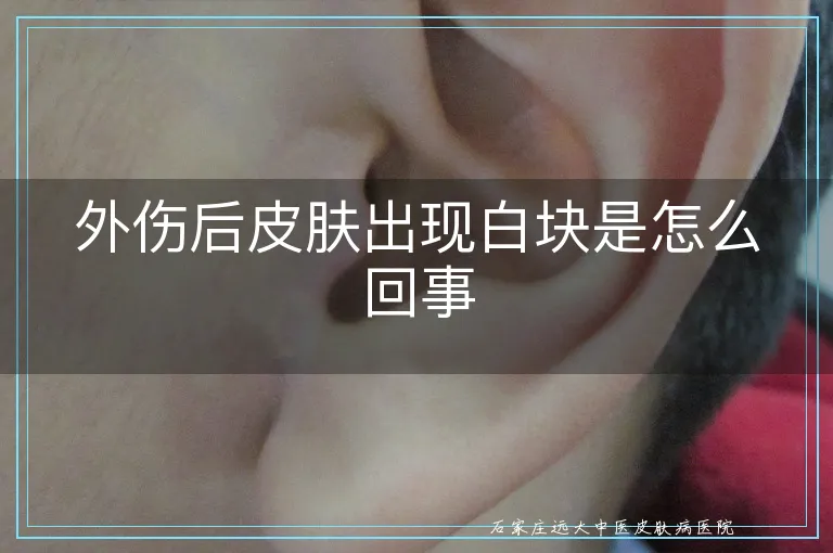 外伤后皮肤出现白块是怎么回事