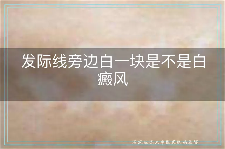 发际线旁边白一块是不是白癜风