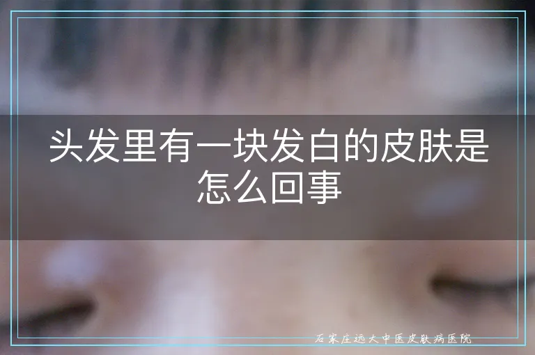 头发里有一块发白的皮肤是怎么回事