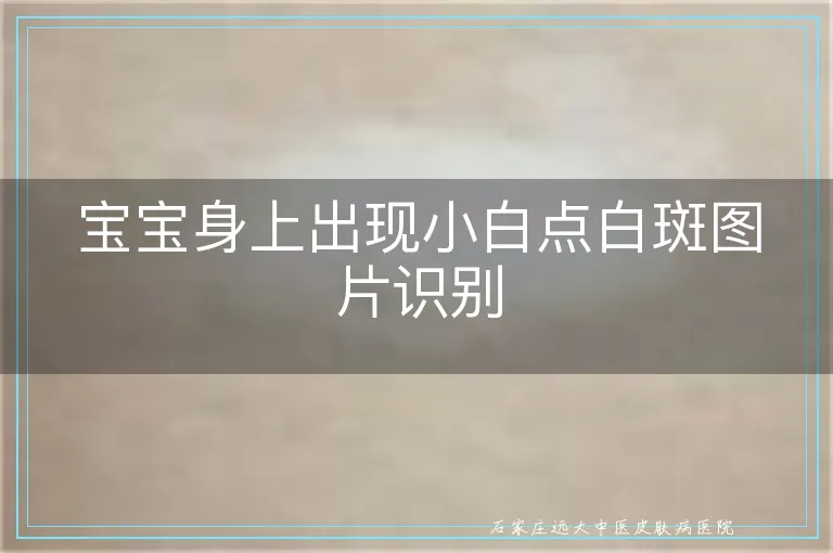 宝宝身上出现小白点白斑图片识别