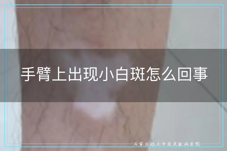 手臂上出现小白斑怎么回事