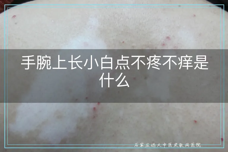 手腕上长小白点不疼不痒是什么