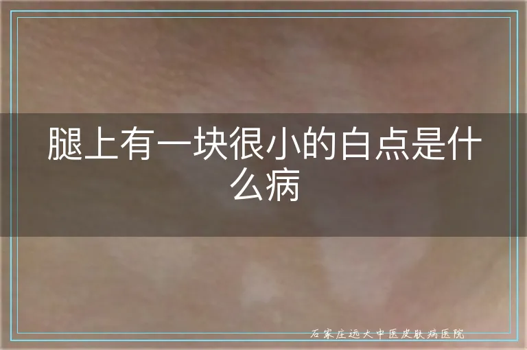 腿上有一块很小的白点是什么病