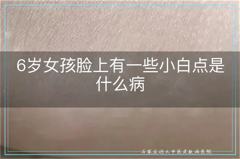 6岁女孩脸上有一些小白点是什么病