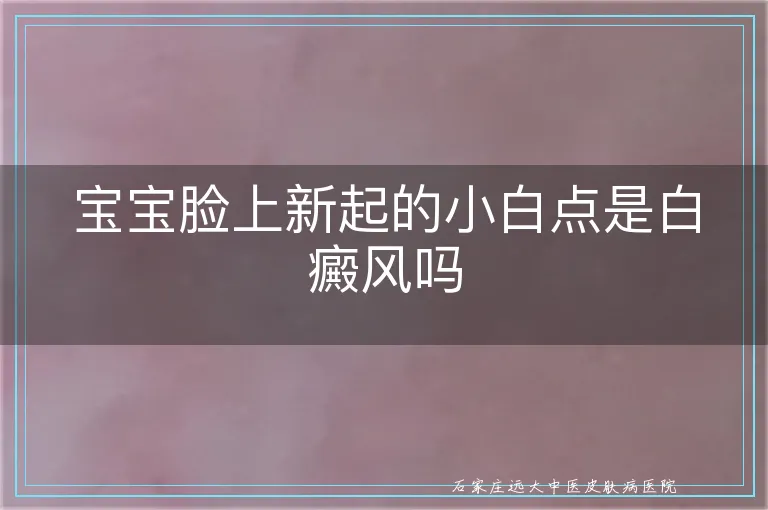 宝宝脸上新起的小白点是白癜风吗