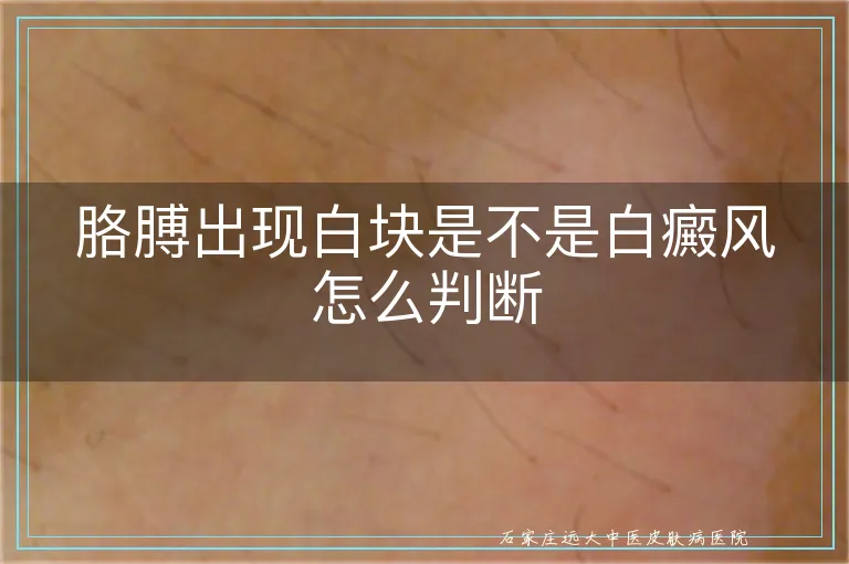 胳膊出现白块是不是白癜风怎么判断