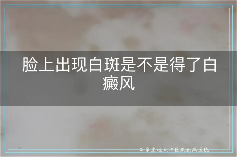 脸上出现白斑是不是得了白癜风