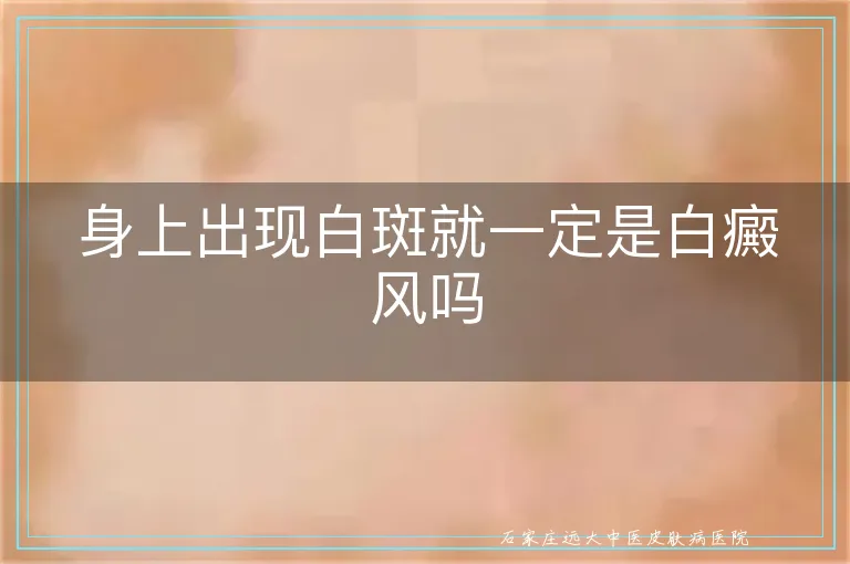 身上出现白斑就一定是白癜风吗