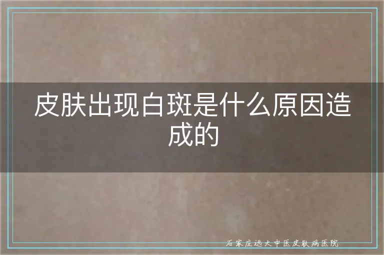 皮肤出现白斑是什么原因造成的