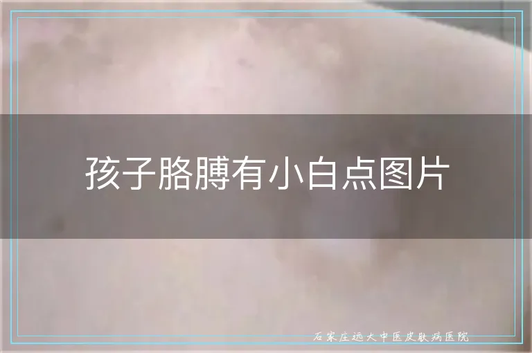 孩子胳膊有小白点图片