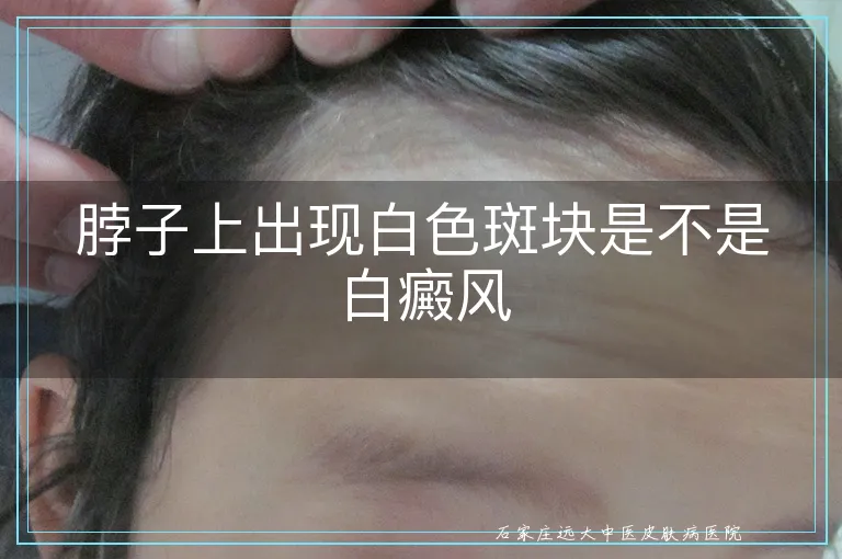 脖子上出现白色斑块是不是白癜风